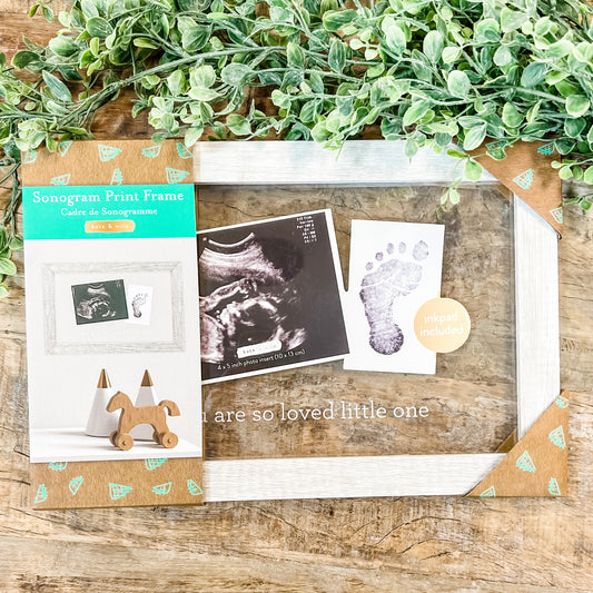 You are So Loved Floating Sonogram Frame